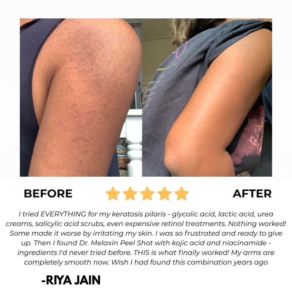 BrightBody Pro Exfoliator