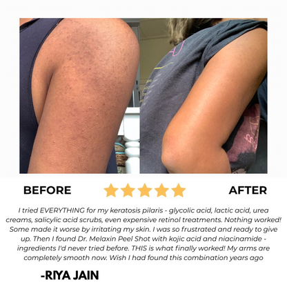 BrightBody Pro Exfoliator