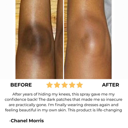 BrightBody Pro Exfoliator