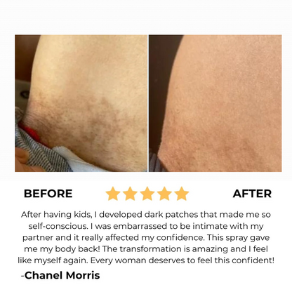 BrightBody Pro Exfoliator